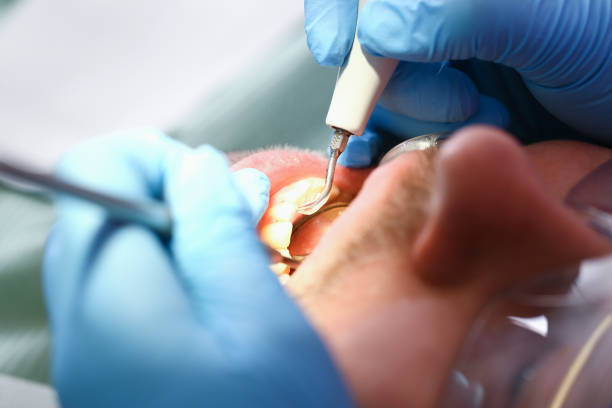 Best Dental Emergency Near Me  in Jacksonvle, IL