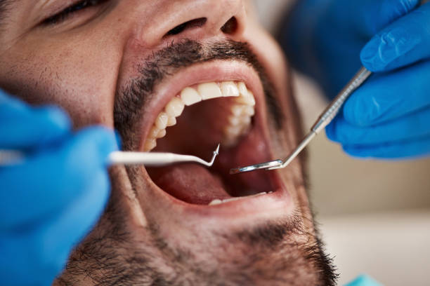 Best Broken Tooth Emergency  in Jacksonvle, IL