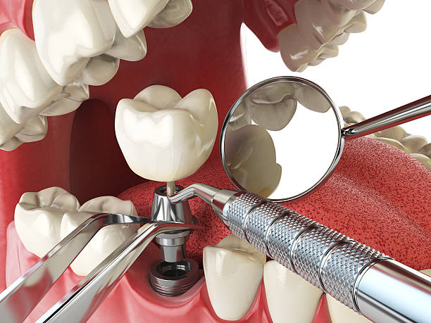 Best Tooth Pain Emergency Relief  in Jacksonvle, IL
