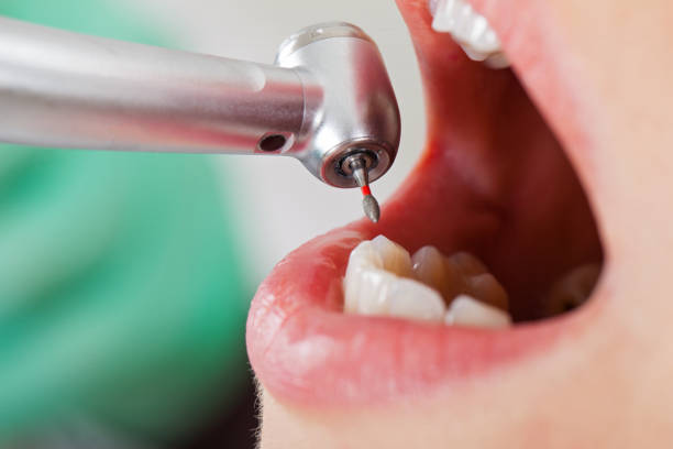Best Knocked-Out Tooth Emergency  in Jacksonvle, IL